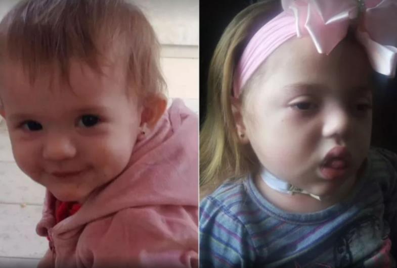 Bebê que se afogou em balde e perdeu movimentos completa 2 anos: 'Cura seria presente', diz mãe