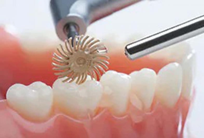 Qual a melhor restauração que pode ser feita no consultório odontológico?