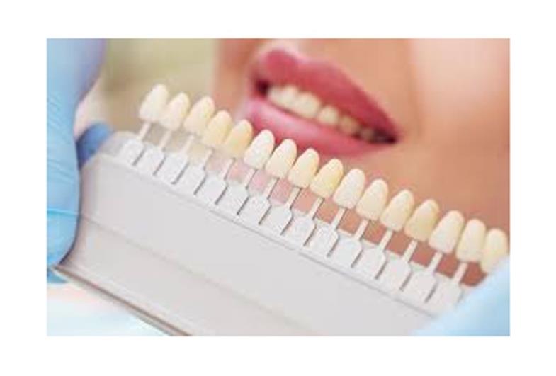 Dúvidas sobre o clareamento dental?