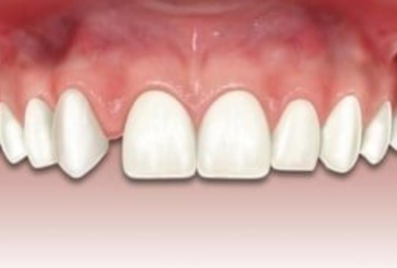 Como ocorrem as anomalias dentárias?