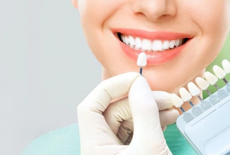 Clareamento dental é tudo a mesma coisa?