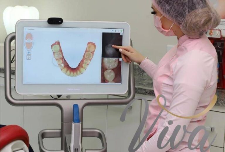 VOCÊ JÁ CONHECE O ESCANEAMENTO INTRA-ORAL?